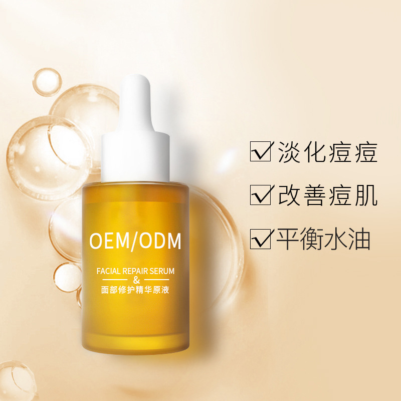 汕尾市_祛痘精华原液OEM
